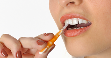 SSO: Studie zu Interdentalzahnbürsten