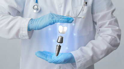 Artificial intelligence and augmented reality in implant planning