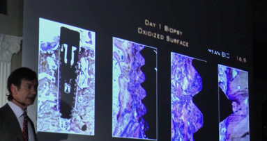 „Od osteointegracji do periointegracji” – implanty szorstkie czy maszynowe?