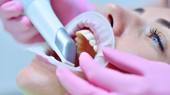 Intra-oral scanning: Current capabilities and ongoing developments