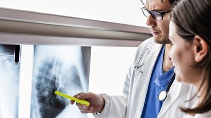 Dentistas desenvolvem teste de saliva para o câncer de pulmão