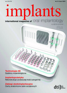 implants Poland No. 1, 2018