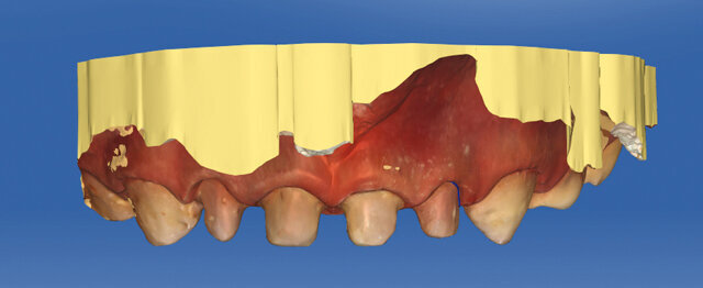 Optický sken situace