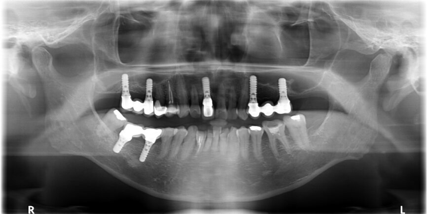 Fig. 2: Panoramic radiograph.