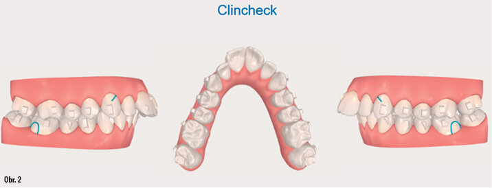 Kazuistika - popis v textu