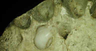 Un caso di iperdontia in un reperto di epoca tardo romana proveniente dalla grotta-ossario di Susa (To)