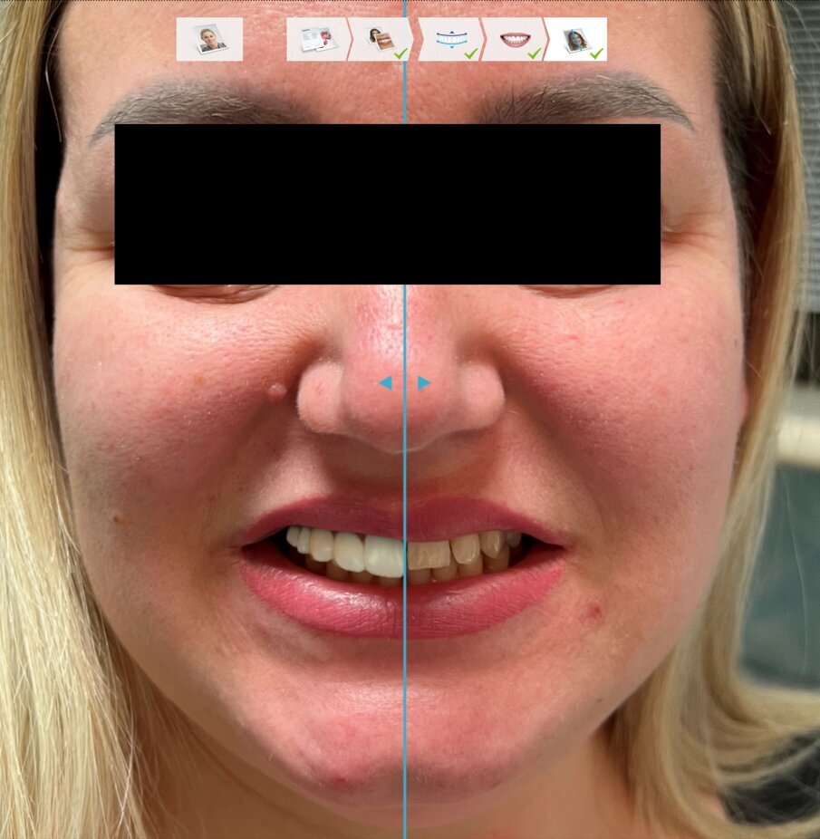 Fig. 9 - Simulazione.