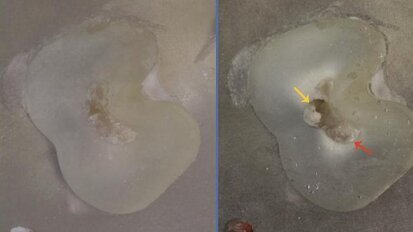 Dentine thickness in buccal roots of maxillary first premolars following preparation with three techniques