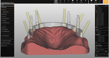 Tecnica “Double Screw Metal”
