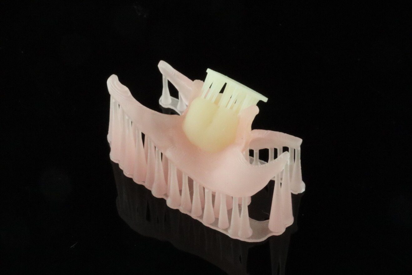 Fig. 3a: Printed denture tooth and flexible denture base assembled to create the provisional partial denture.