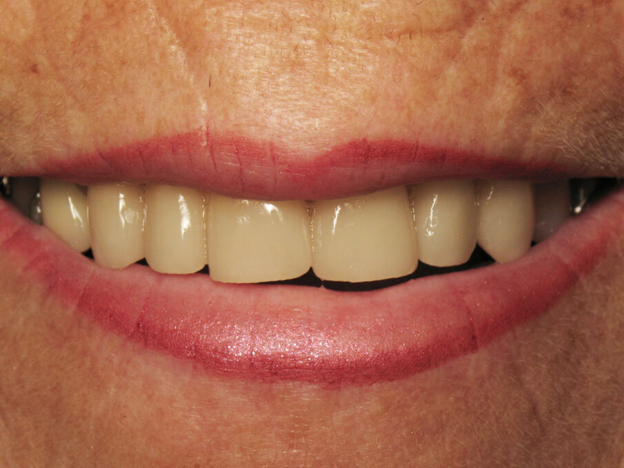 Fig. 11: Final result.