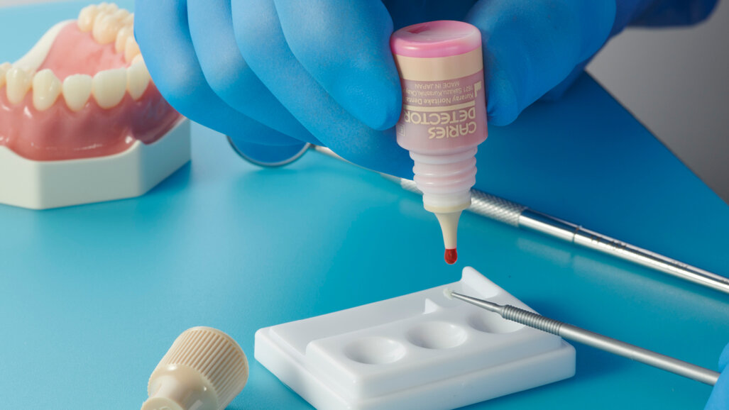 CARIES DETECTOR: Enhancing precision in conservative caries removal