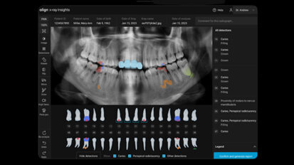Align Technology introduces new software innovations designed to accelerate digital practice transformation