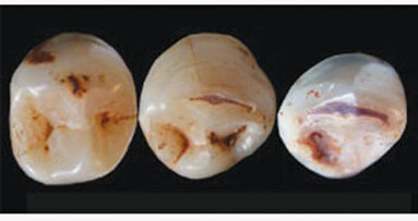 Ancient teeth raise new questions