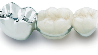 Aurident marks 35 years of making alloys Aurident marks 35 years of making alloys