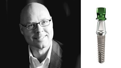 Implantologie smart und einfach: Experte stellt K.I.S.S.-Praxiskonzept vor