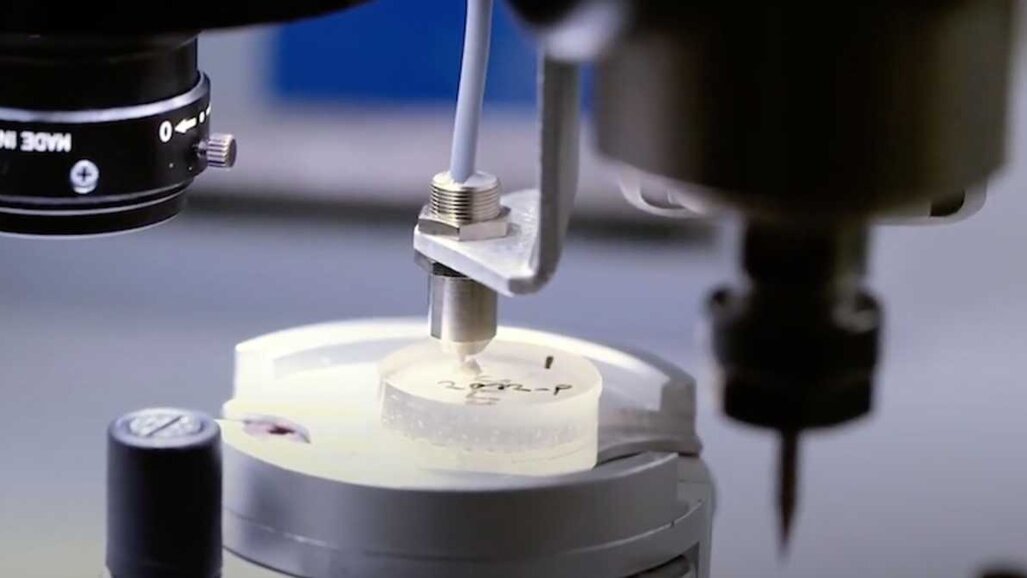 Vědci nalezli v zubech biomarkery neurologických onemocnění