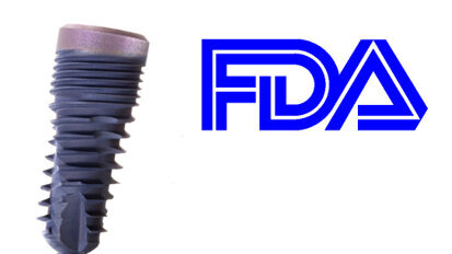 Keystone implant system receives clearance in the US