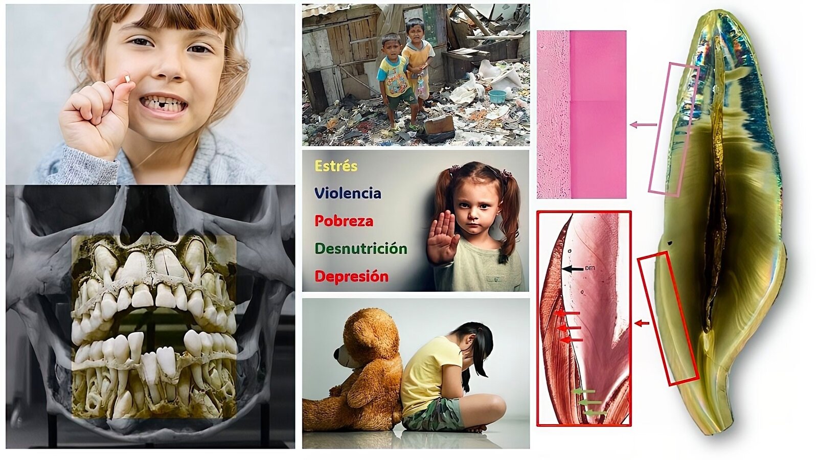 Los dientes, guardianes silenciosos de nuestra salud