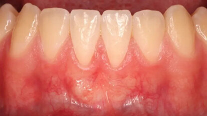 Natasha Lioubavina: “Samen kunnen we gecontroleerde behandelingen aanbieden met betere resultaten”