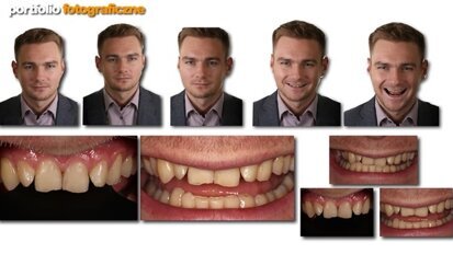 Praktyczne sposoby zastosowania Digital Smile Design w codziennej pracy lekarza dentysty