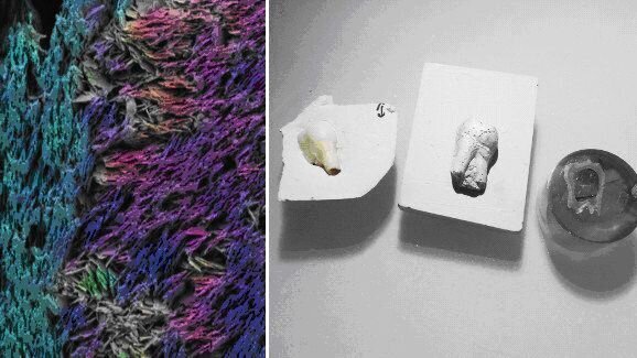 Artificiële tand met natuurlijke microstructuur