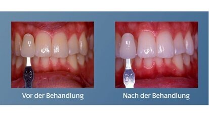 Patientenorientierte Kommunikation mit Whitening Seminaren