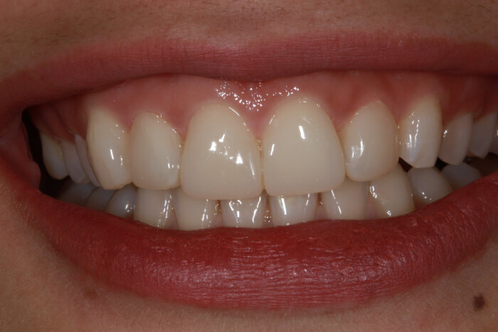 Fig. 7: Final outcome.