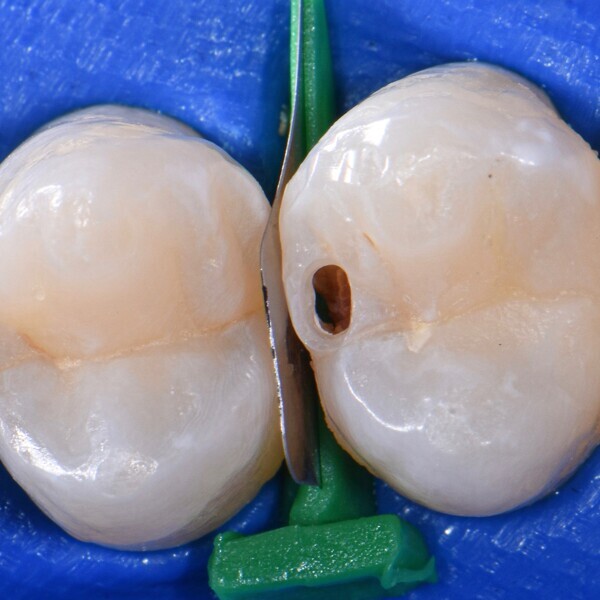 (image: Directa Dental)