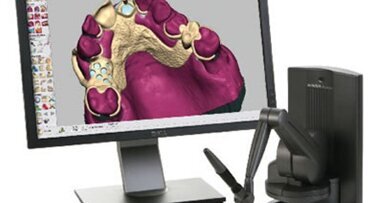 Primena nove tehnologije u zubotehničkim laboratorijama