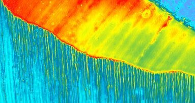 DT Study Club: Webinar behandelt dentale Adhäsivtechnik