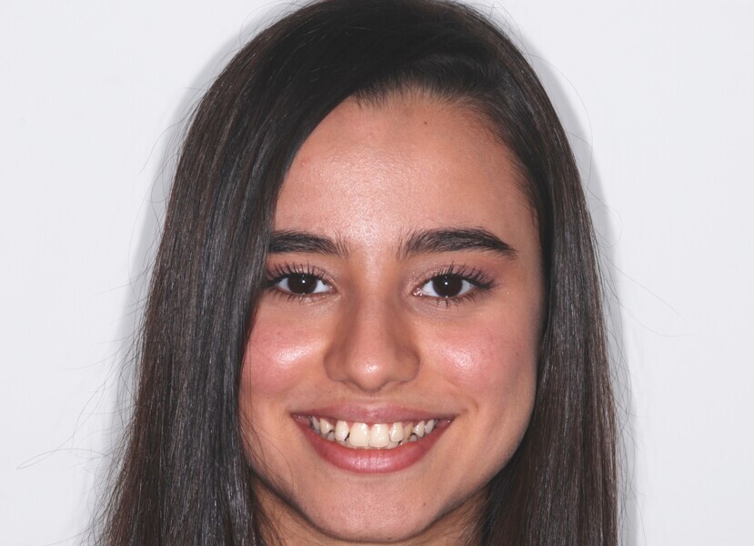 Fig. 1: Full-face frontal view before treatment.