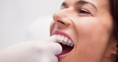 Enquête FFO : Les Français et l’alignement dentaire