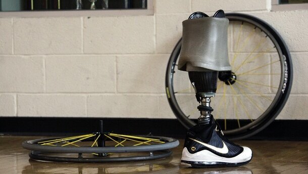 Driekwart menselijk lichaam is vervangbaar door technologie