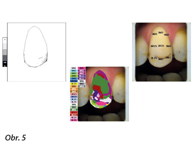 Obr. 5: Detailní translucence (pixel po pixelu) a 9 sekcí mapování odstínů.