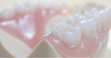 Termoplastické materiály v dentálních technologiích