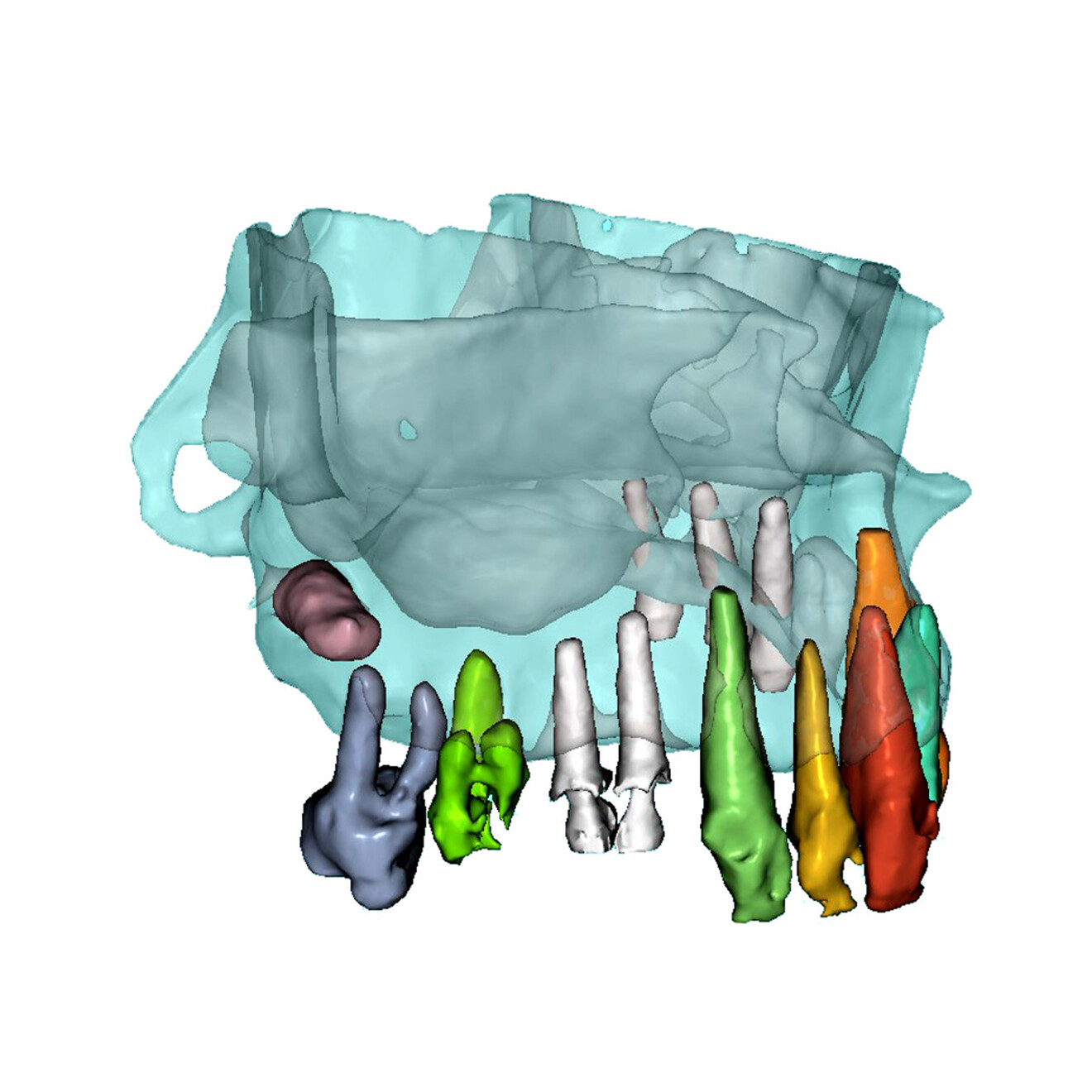 Fig. 6c: Right lateral view.