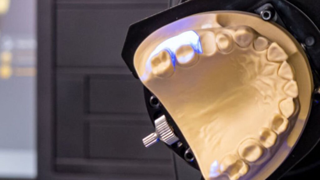 O futuro das restaurações dentárias: vantagens dos sistemas CAD/CAM