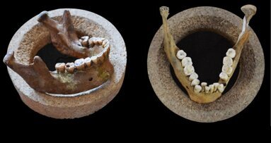 Study finds even earliest farmers had malocclusion