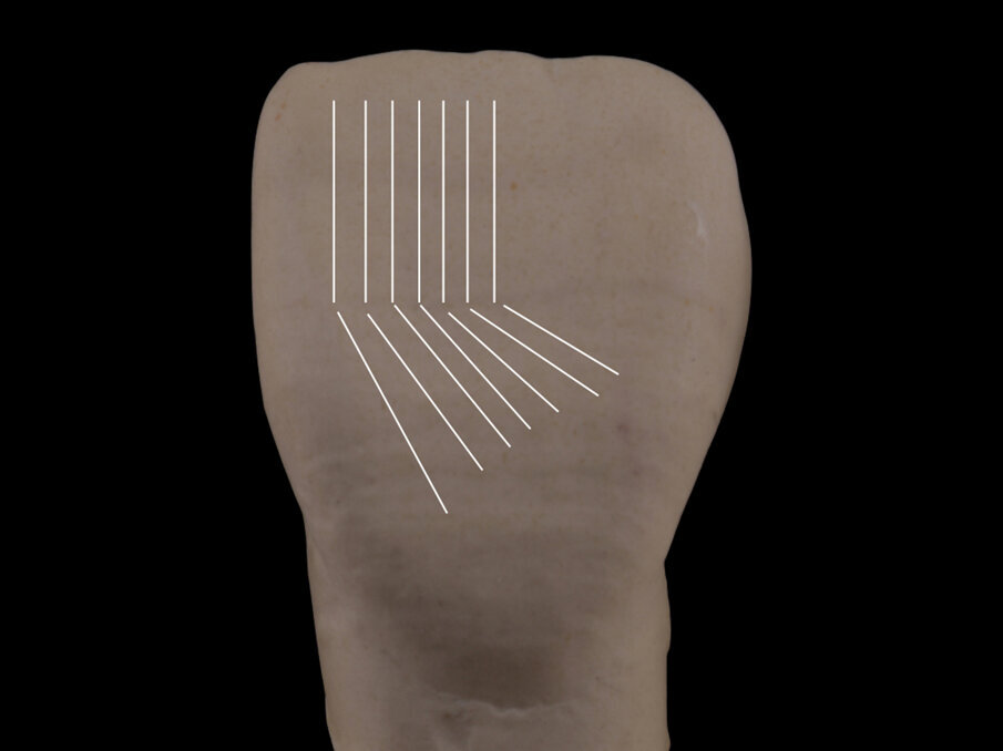 Fig. 10 - Combinazione di linee verticali e oblique: le diverse posizioni e direzioni progettuali cambiano l’illusione visiva.