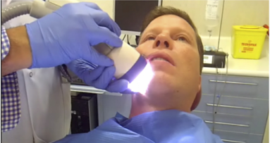 Las ondas de choque llegan a la implantología dental