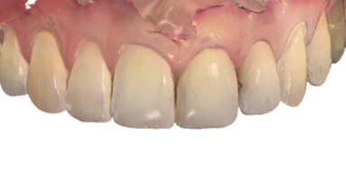 Digitální zubní lékařství v každodenní praxi