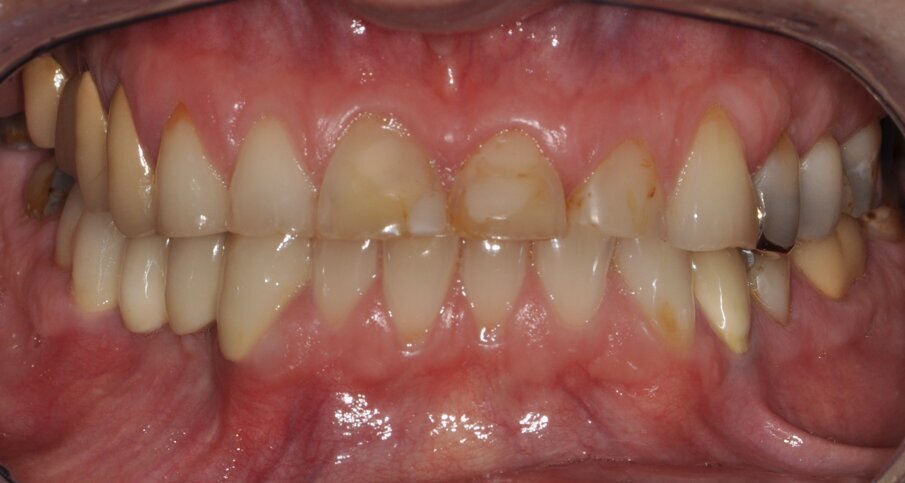 Fig. 1: Clinical baseline situation