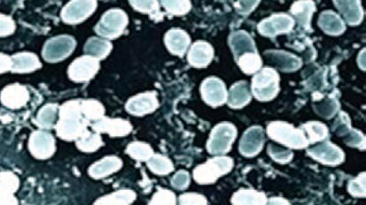 Sodobne tehnike oralne higiene