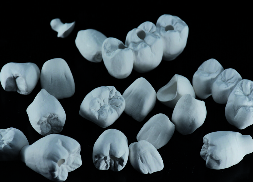 Fig. 6a : Magnifiques résultats après le traitement de surface manuel.