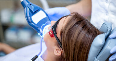 Vital tooth bleaching has adverse effects on oral health, study concludes