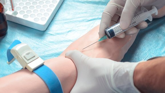 Concentrate Growth Factors (CGF), un preparato dalle varie applicazioni anche odontoiatriche