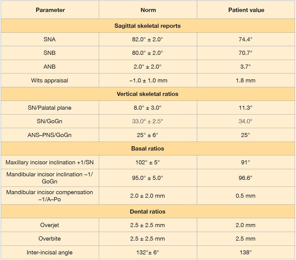 Table 2: Final cephalometric analysis showing sagittal, vertical, basal and dental measurements compared with reference norms.