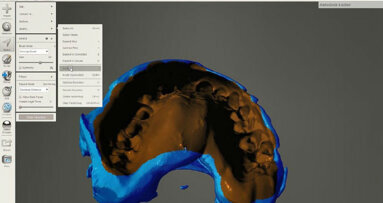 Uso di materiali da impronta radiopachi per ottenere file 3D