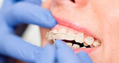 AIO-SIDO le ultime novità in un simposio